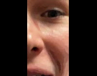 Beautify filter makes an eye in the nose