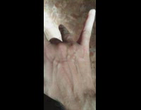 Guy Can Move Veins in Hand 