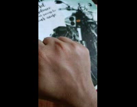 Man Clenches Hand to Show Deep Scar