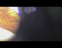 Guy looks at fly leg under microscope 