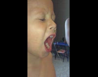 Slow motion kid tooth pulled out using string