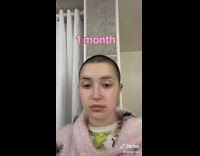 Collab BitchIG2 - One year progress of buzzcut hair growth for woman