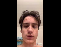 Guy forehead full of pimples 