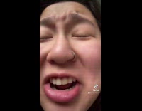 Collab BitchIG2 - Girl shows allergic reaction to mosquito bites