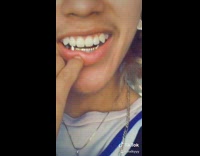 Guy in Warriors jersey shoes off diamond grill on bottom row teeth 