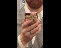 Man teeth covered phone cover inside train