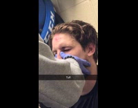 Woman pressed back down man fractured nose