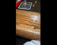 Wind up toy car rolls into girls mouth 