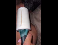Collab Clips MPUGC - Woman used lint roller for sunburned skin 