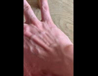 Collab DailyDoseOfInternet - Guy move vein back of his hand