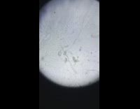 Microscope view of the waterdrop from the pond