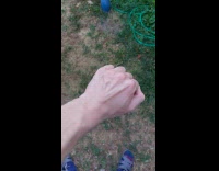 Man moves veins by wiggling finger bones