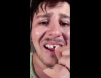 Guy uses mousetrap on tongue loses tooth 