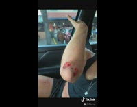 Girl falls off skateboard gets injured fail 