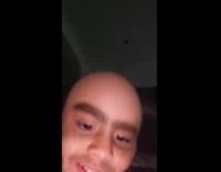 Kid sees self with bald filter 