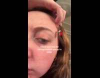 Woman slept over earrings pricked on face