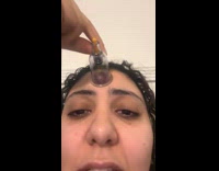 Girl cupping forehead marked