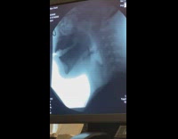 Collab Bitch MP - Xray of person eating and swallowing food 