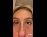 Girl one eye is more dilated bathroom 