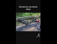 Person showing amputated leg after motorcycle accident 