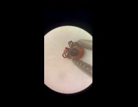 Tick extends limbs when abdomen is pressed