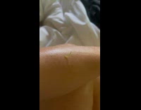 Worm Crawls and Shakes Body on Arm