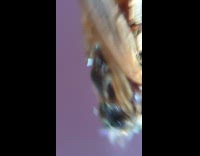 Mosquito larvae under the microscope 