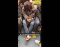 Peron sleeping teeth dentures fell out of mouth