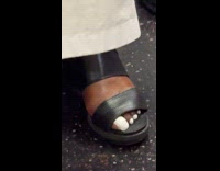 Woman with strange toenail on subway