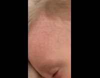 Sleeping boy with batman logo veins on head