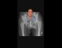 Nurse shows magnetic beads that men stick up their penis 