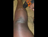 Guy greets for easter with leg 