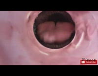 View from Dog Food Container 