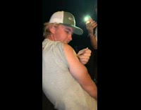 Guy puts a lit cigar into his arm and burns skin