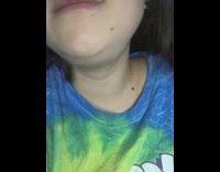 Woman can inflate chin like a frog