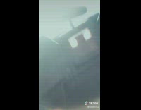 Woman tells story about getting shot in eye 
