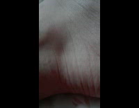 Vein in ankle foot throbs moves girl 