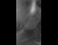 Girl headbangs hits phone forehead fail filter 