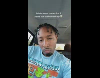 Guy shows off big front teeth 