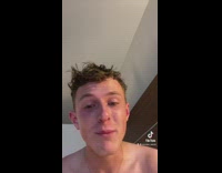 Guy shows chemical burn on armpit from using old spice deodorant 