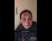 Girl swings on tree rope falls face