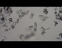 Time lapse crystal grow seen under microscope