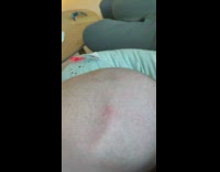 Baby soft spot on skull head pulse