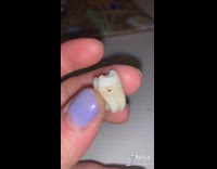 Girl gifts boyfriend guy wisdom tooth necklace 