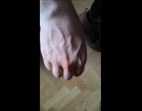 Vein on the back of hand moves