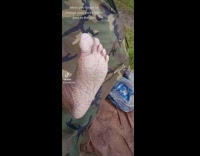 When you forget to change your socks in the field 