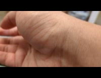 Man shows pulse seen from his hand 