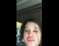 Girl big swollen lips 