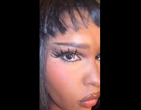 Collab ClipsIG - Womans allergic reaction to mosquito bite 