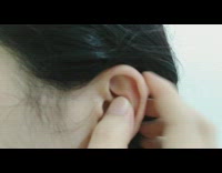 Girl with pointy bump on outer ear